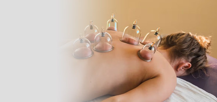 Hijama at igood.ca